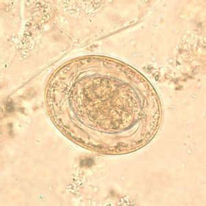 Hymenolepis diminuta — scolex and egg microscopy